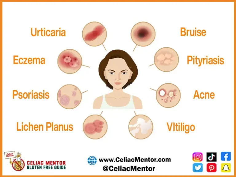 What are the Effects of Celiac Disease on Skin?